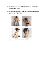 흉곽출구증후근-9