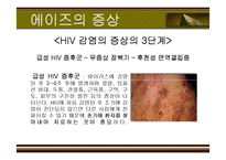 [성의 역사] 에이즈와 성병-8