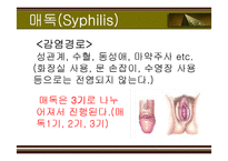 [성의 역사] 에이즈와 성병-18
