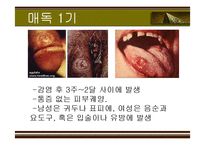 [성의 역사] 에이즈와 성병-19