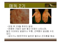 [성의 역사] 에이즈와 성병-20