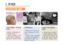 프리온과 광우병의 흐름과 영향-5