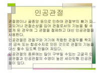 의료용 고분자 레포트-18