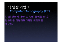 뇌의 인위적 향상 논쟁-12