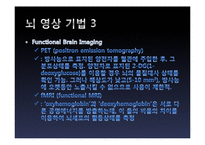 뇌의 인위적 향상 논쟁-14