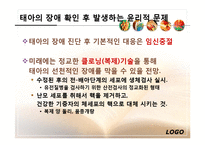 산전선별검사, 성 그리고 복제-7