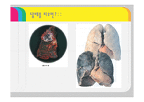 [교육학] 2007개정 중2 과학 수업 지도안-호흡과 배설-18
