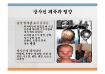 [공학] 원자력 발전의 현재와 미래-18