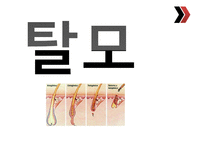 [스포츠교육] 탈모에 좋은 운동과 탈모 예방법-1