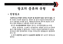 [스포츠교육] 탈모에 좋은 운동과 탈모 예방법-7
