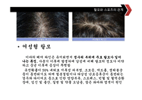 [스포츠교육] 탈모에 좋은 운동과 탈모 예방법-9