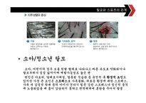 [스포츠교육] 탈모에 좋은 운동과 탈모 예방법-12