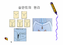 [치의학] 치면열구 전색제를 오래 유지하는 방법-2