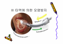 [치의학] 치면열구 전색제를 오래 유지하는 방법-11