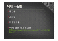 낙태에 대한 찬반 논란-11