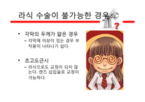 라식, 라섹 수술의 장단점과 부작용 정보-6