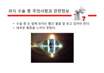 라식, 라섹 수술의 장단점과 부작용 정보-10