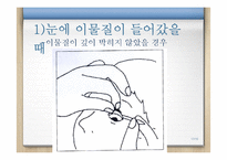 [아동간호] 영유아기 `이물질 흡입` 안전사고 치료와 예방-17