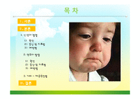 [간호학] 아동 발열의 원인과 증상 및 치료와 예방-2