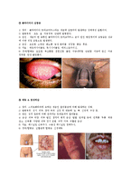 성병(Venereal disease)의 사례와 종류 및 예방-5