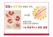 성병(Venereal disease)의 사례와 종류 및 예방-16