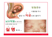 성병(Venereal disease)의 사례와 종류 및 예방-17