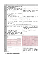 [건강과 간호] 심장철 package-4