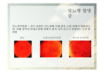 당뇨병의 증상과 예방법-9