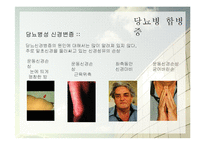 당뇨병의 증상과 예방법-11