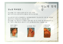 당뇨병의 증상과 예방법-12