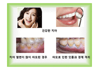[소비자행동론] 애경 2080 청은차 치약 마케팅분석 및 전략-2