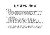 엉덩관절 골절과 무릎관절 치환술-11