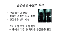 엉덩관절 골절과 무릎관절 치환술-16