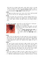 [간호학] 인도, 싱가폴 식습관과 소화기 질환 조사-9