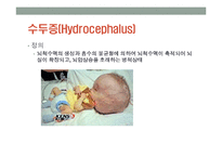 [간호학] 수두증 실습-4