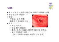 [간호학] 인도, 싱가폴 식습관과 소화기 질환 조사-10