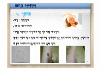 [재활공학] 보조기구 개조 및 제작안-8