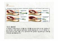 성, 동거에 대한 대학생의 인식-19