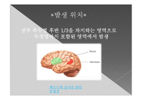 뇌의 언어장애와 실어증-9