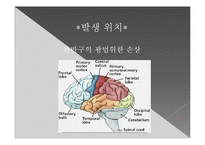 뇌의 언어장애와 실어증-18