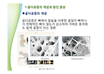 골다공증과 영양학-4