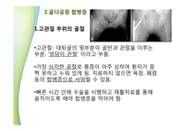 골다공증과 영양학-13
