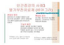 인간 증강 반대-11