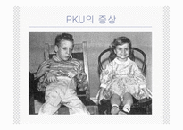 [생화학] 페닐케톤뇨증(phenylketonuria,PKU)-3