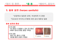 [간호학] 성전파성 질환-13