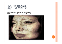 [영양학] 현대인의 다이어트와 3대영양소 결핍과 과다-17