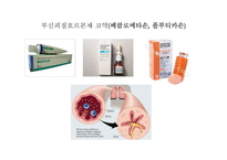 비염의 증상, 일반약 추천과 복약지도-20