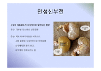 만성신부전 개별사례-2