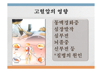심혈관계질환의 이해와 방지-19
