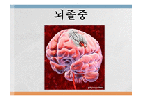 심혈관계질환의 이해와 방지-20